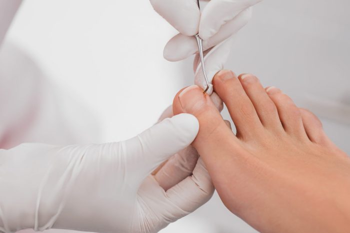 Podolog,Removes,The,Cuticle,On,The,Nails,Using,Hardware.